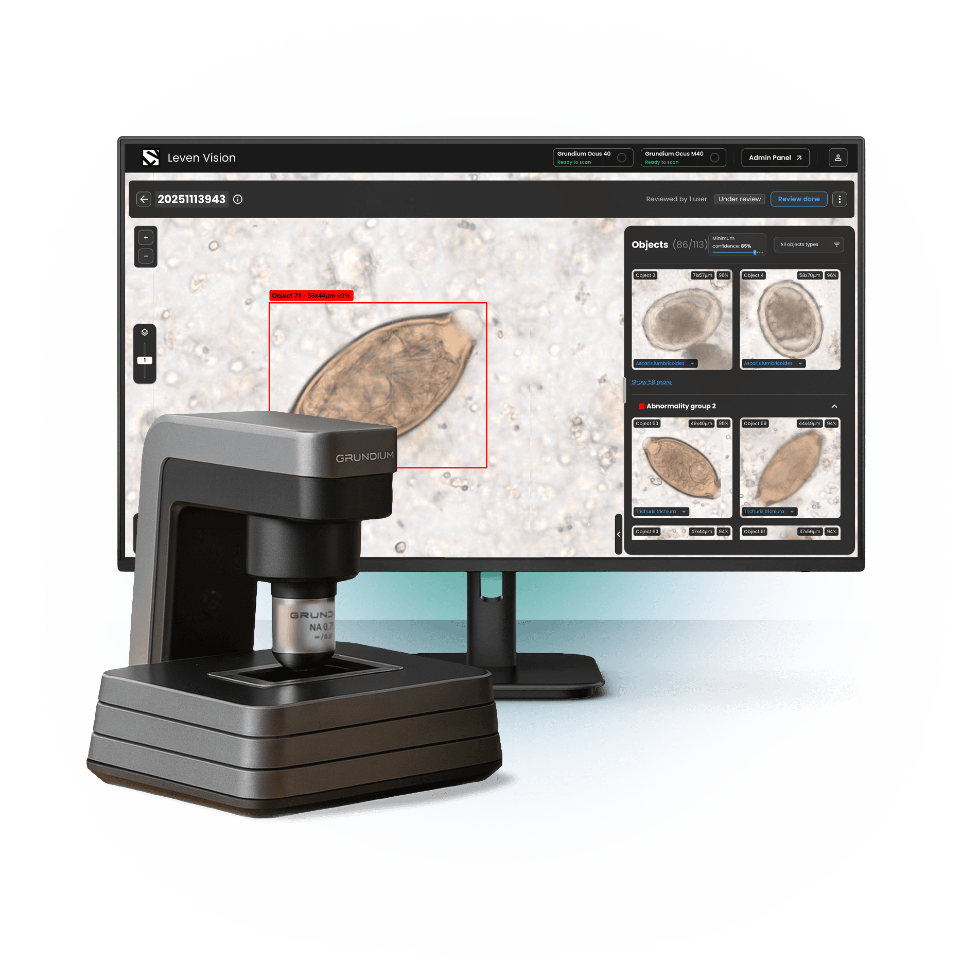 ParaScout AI automated microscope scanner connected to a monitor showing the diagnostic platform with a detected parasite egg and object measurement details.