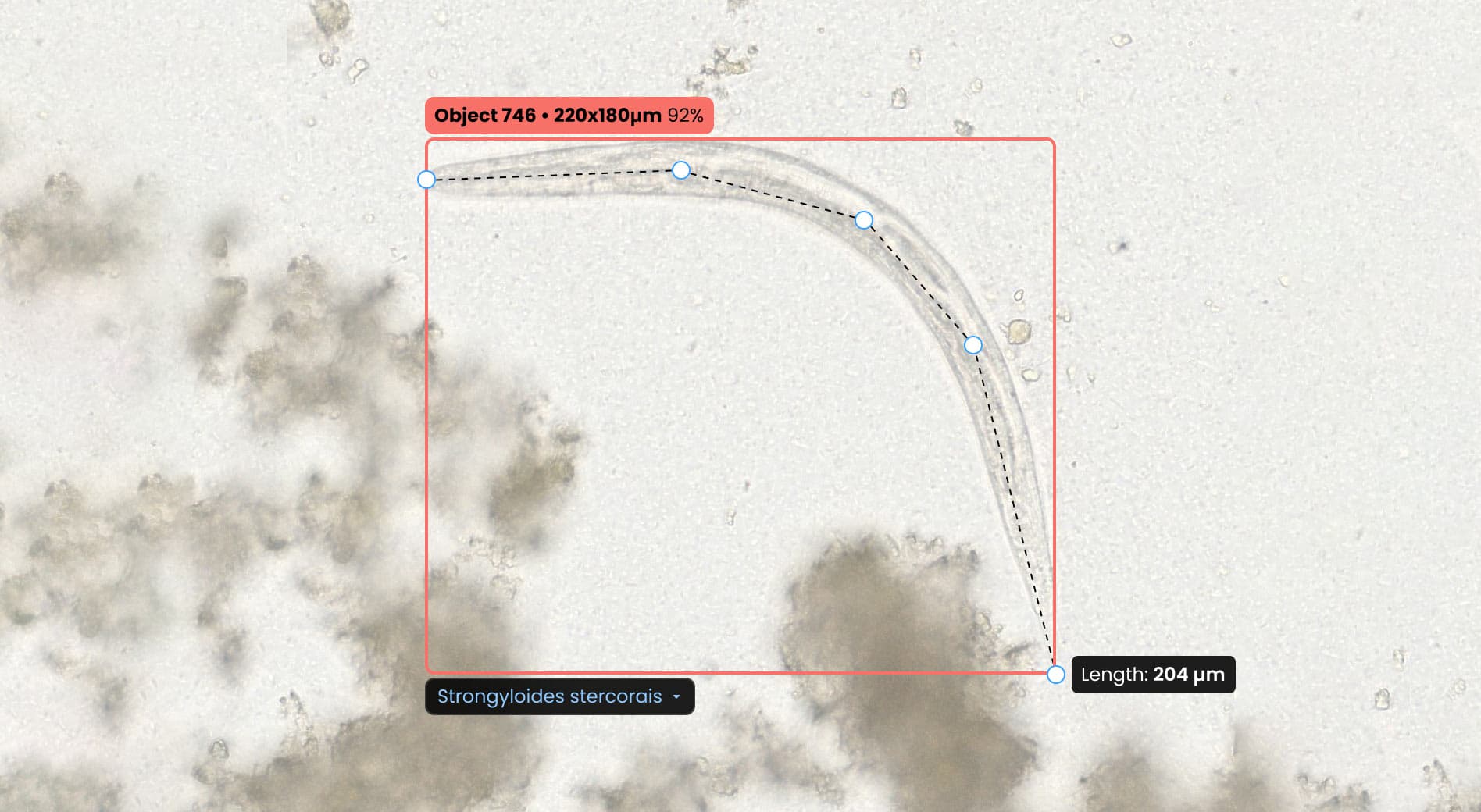 ParaScout AI feature showing automated larval length measurement of Strongyloides stercoralis, assisting in species differentiation for accurate diagnosis