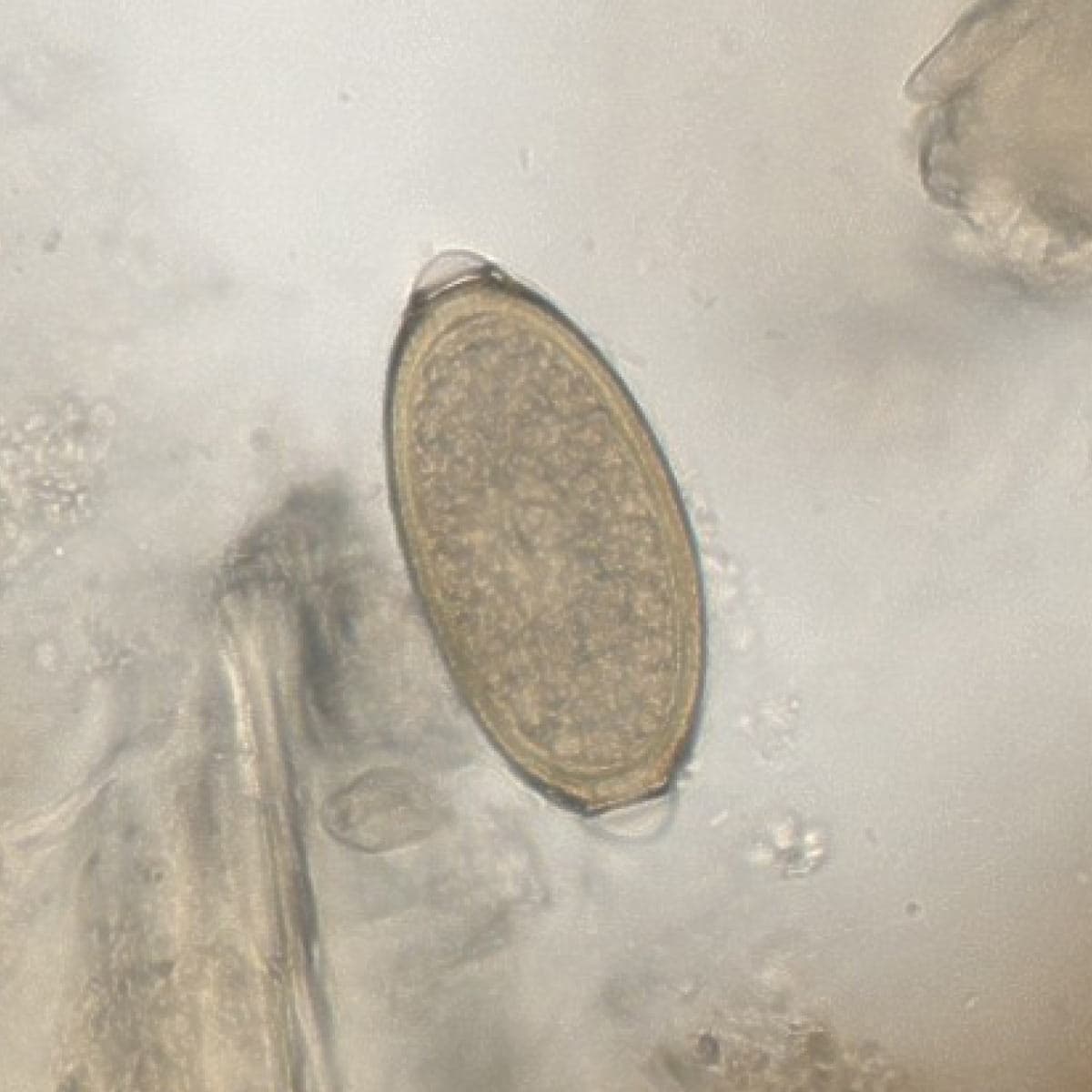 Capillaria spp. egg with distinct bipolar plugs, AI detection box, automated measurement (23x40 µm), and 94% confidence score.