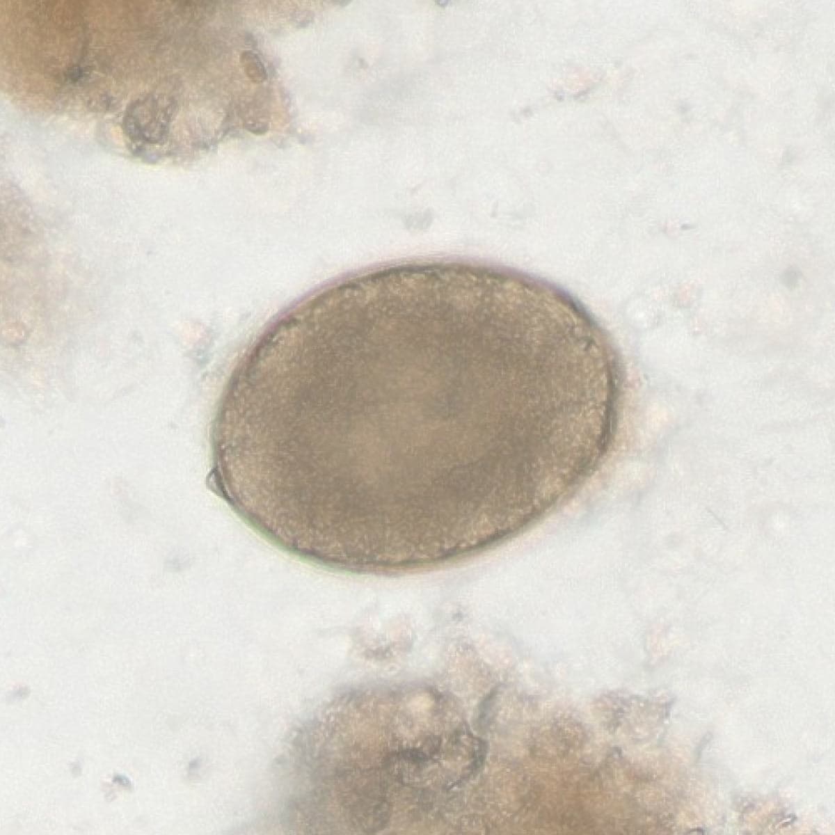 ParaScout AI microscopic image showing a large Diphyllobothrium spp. egg, AI detection box, automated measurement (58x40 µm), and 96% confidence score.