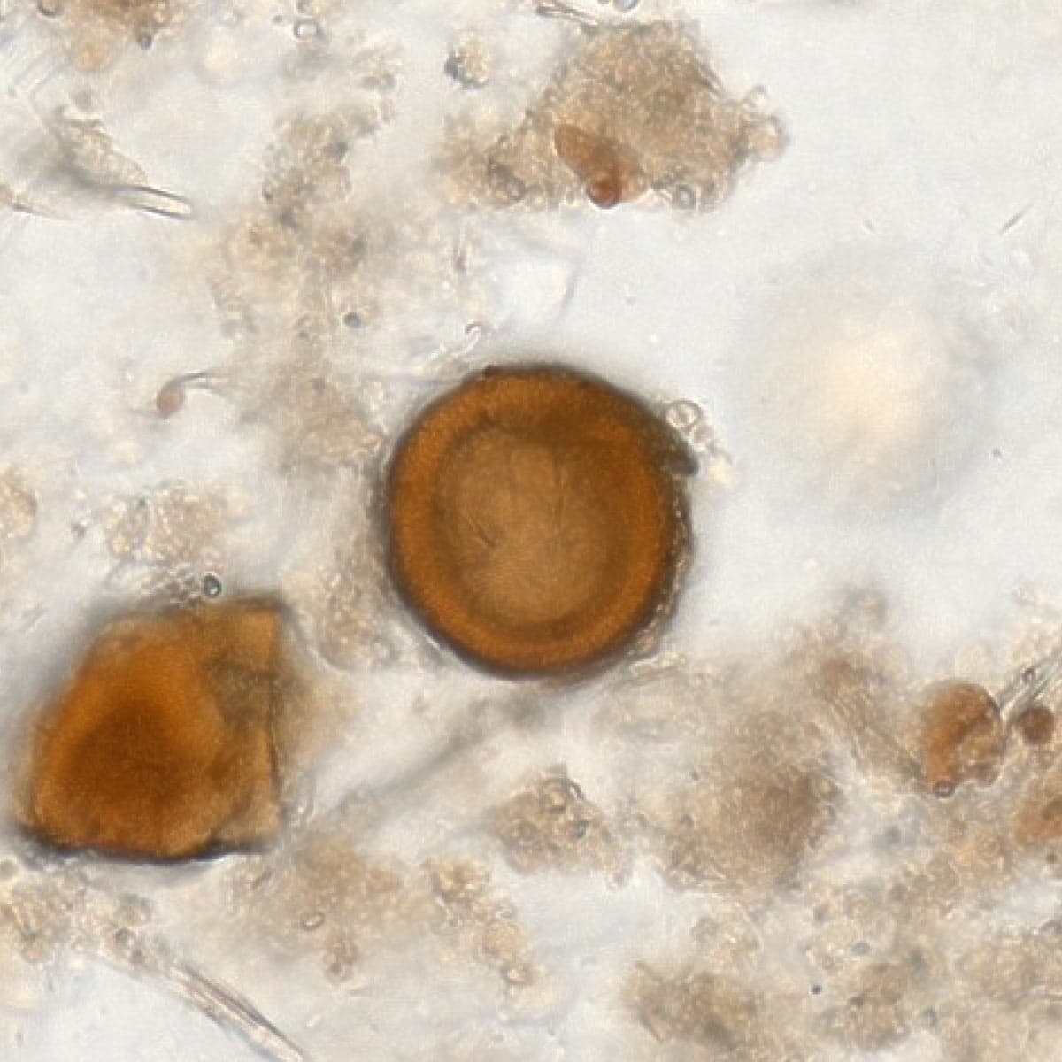 ParaScout AI microscopic image showing the thick-shelled, radially striated Taenia spp. egg, AI detection box, automated measurement (37x35 µm), and 92% confidence score.